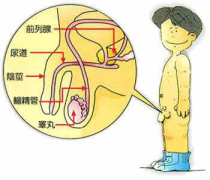  附睾炎的检查诊断